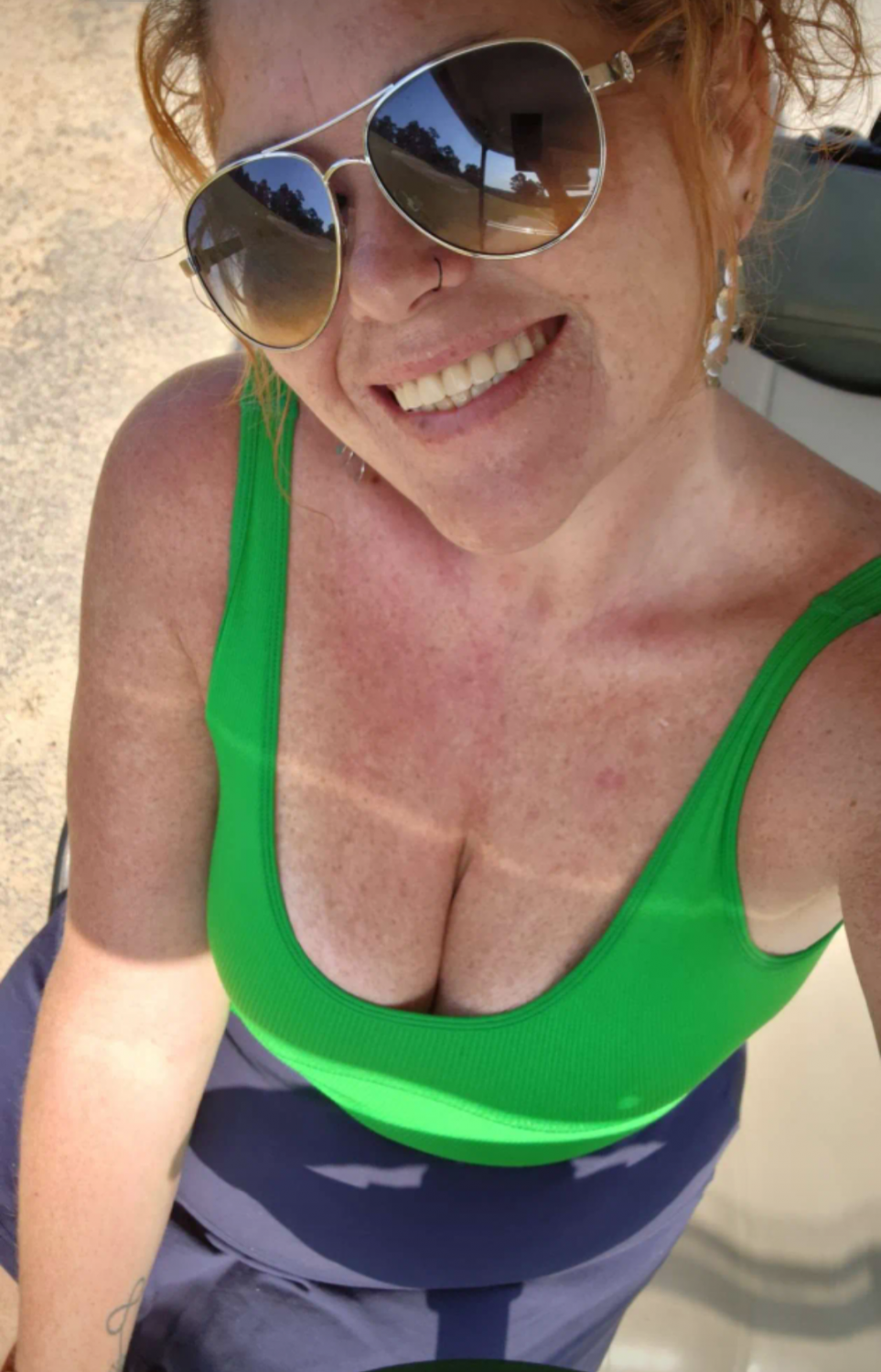 Sexy Freckles #WlkFkIli